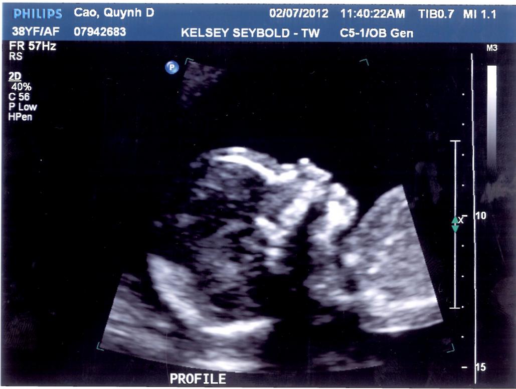 Em còn ngáp cho Ba Mẹ coi nữa. Phải chi con cũng cảm nhận được niềm vui này.