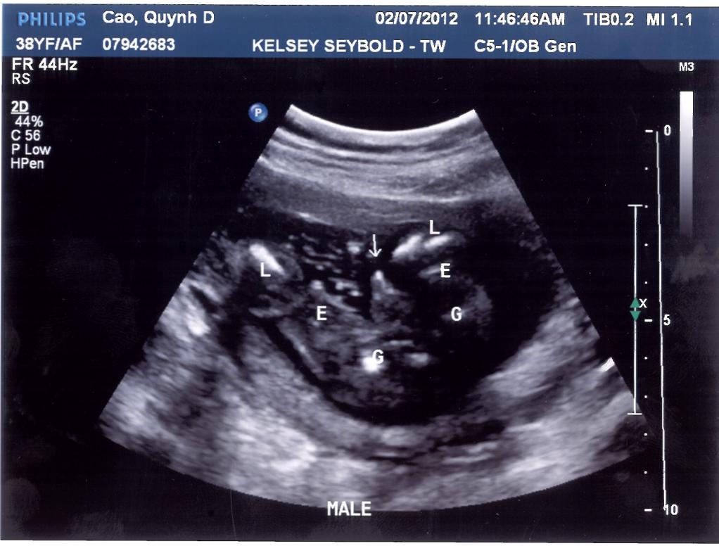 Mong rằng con sẽ thích 'món quà' em trai Ba Mẹ tặng con hen.