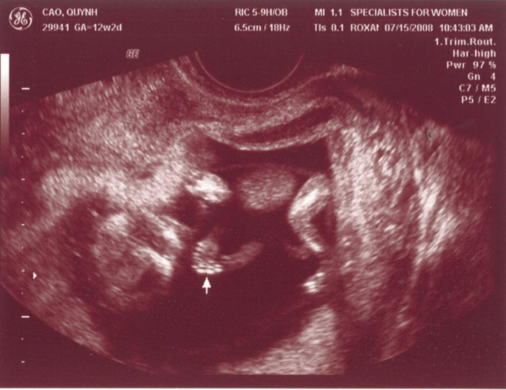 1 tuần sau tay chân con đã dài ra rồi, lẹ ghê...