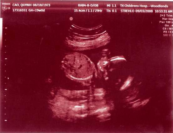 Ngày 9/3/2008, Mẹ chưa muốn biết con là trai hay gái vì muốn bất ngờ, nhưng rồi cuối cùng cũng không đợi được...