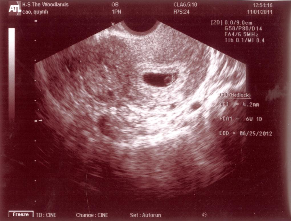 Ngày 11/1/2012, em chỉ là hạt nhân nhỏ xíu, giống con ngày nào...