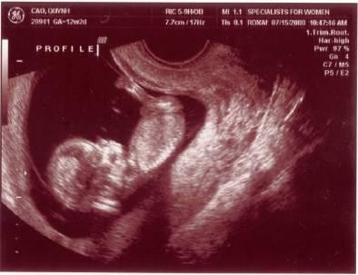 ...biết nhào lộn vòng vòng nữa, mới nằm úp giờ nằm ngửa rồi.